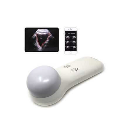Buy Wireless 4D Portable Bladder Scanner for Point-of-Care Urinary Volume Measurement online manufacture