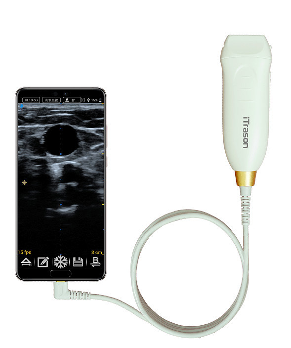 64 Channel 20mm Depth Handheld Ultrasound Scanner For Peripheral Vascular Assessment and Ultrasound-Guided Vascular Access