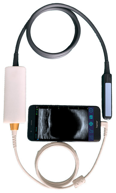 Handheld Veterinary Ultrasound Scanner with Linear Rectal Probe for Bovine & Equine Reproduction