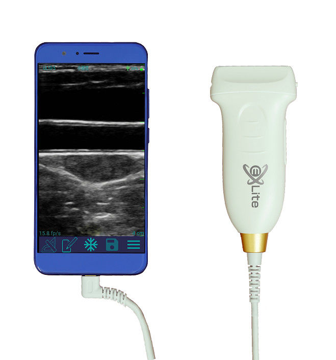 10MHz Portable Wireless Android Ultrasound Scanner With Type-C Connection