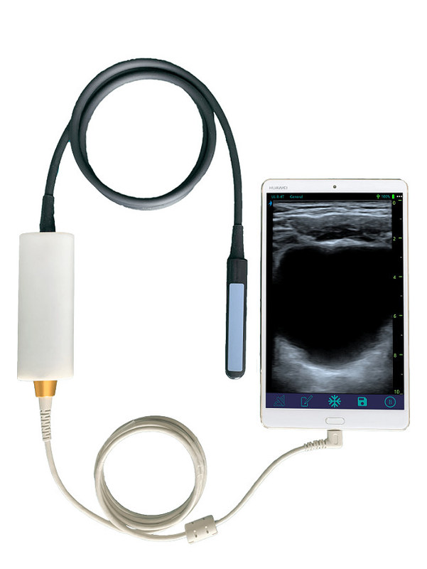 Handheld Veterinary Ultrasound Scanner with Linear Rectal Probe for Bovine & Equine Reproduction