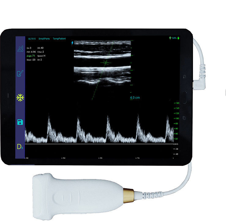10MHz Portable Wireless Android Ultrasound Scanner With Type-C Connection