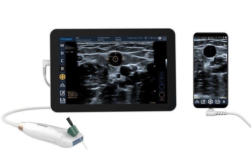 64 Channel 20mm Depth Handheld Ultrasound Scanner For Peripheral Vascular Assessment and Ultrasound-Guided Vascular Access