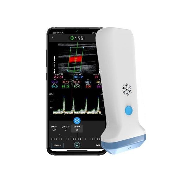 12.6cm Portable Color Doppler Ultrasound Scanner For Healthcare Professionals