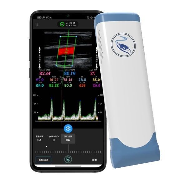 Echo Color Doppler Wireless Handheld Ultrasound Scanner 100 Frames