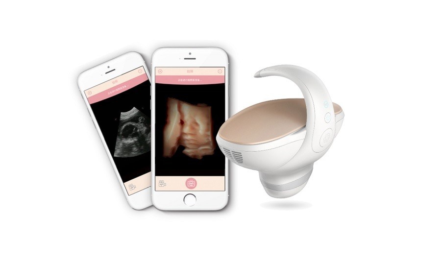 CE Approved 3D/4D Handheld Fetal Ultrasound Scanner
Portable Pregnancy Imaging Solution with 60° Wide-Angle Convex Probe