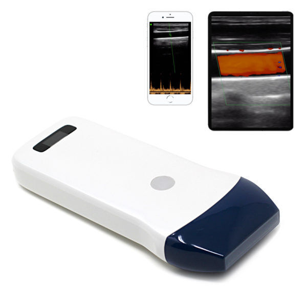 Wireless Linear Probe Ultrasound Scanner for Vascular Access, Nerve Block and Musculoskeletal Imaging