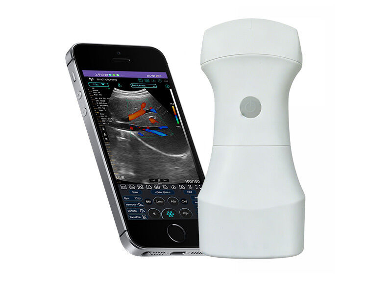 Wireless Pocket Convex Ultrasound Scanner with Replaceable Battery for Portable Clinical Imaging