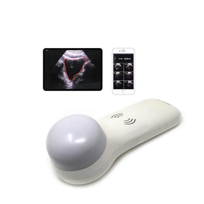 Wireless 4D Portable Bladder Scanner for Point-of-Care Urinary Volume Measurement