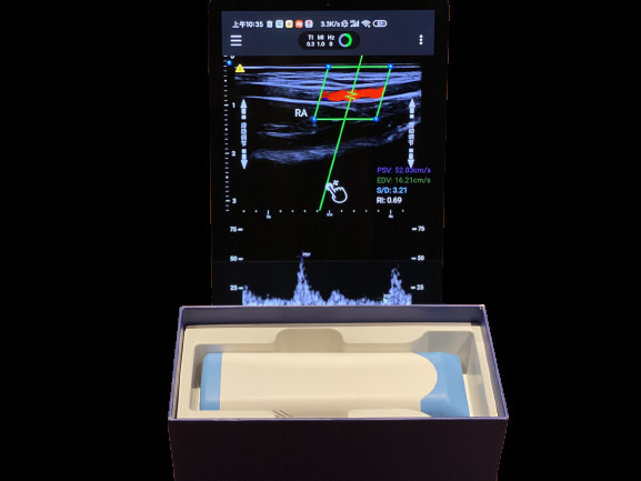 Linear Array Scanner Electronic Linear Array Handheld Ultrasound Scanner With 2 Hours ...